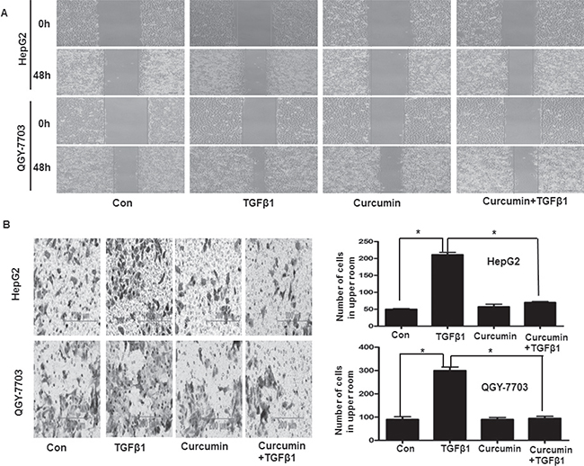 Curcumin inhibited TGF-&#x03B2;1-induced invasion and metastasis in hepatoma cells.