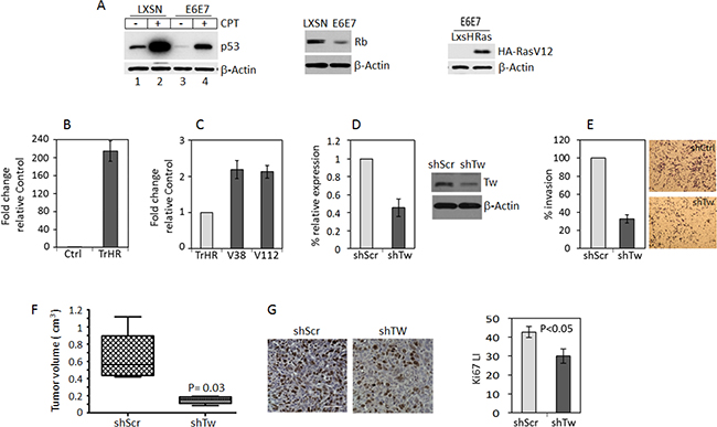 TW knockdown in HPV E6/7 transformed neural progenitor cells (NPCs) inhibits tumorigenicity.