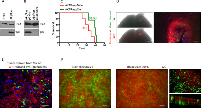 Outgrowth of TW+ cells after implantation of unsorted Akt/Ras NPCs infected with Cre recopmbinase.