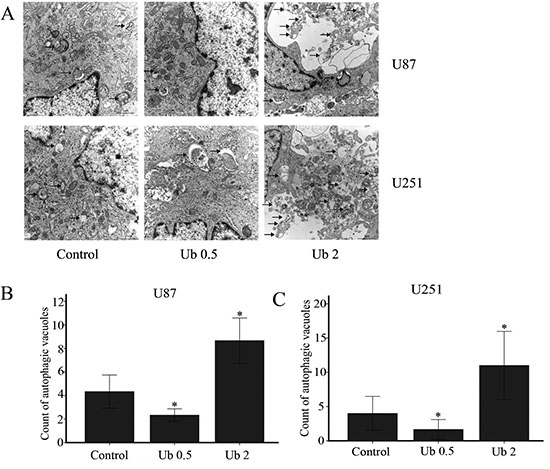 Ubenimex influenced the level of autophagy in U87 and U251 cells.
