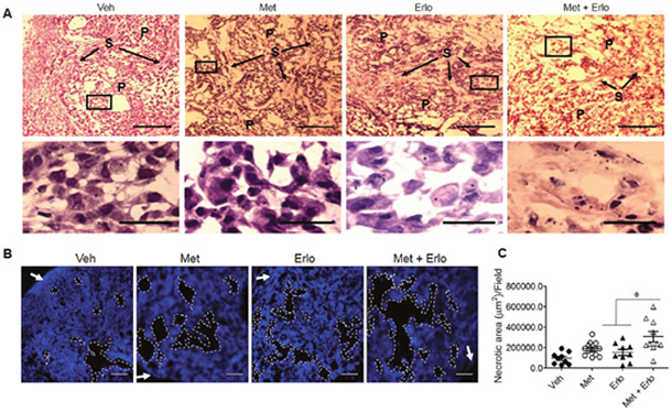 Enhancement of cell apoptosis by Erlo on xenograft lung cancer by Met.