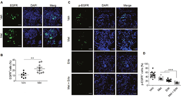 Enhancement of EGFR expression by Met and reduced phosphorylation of EGFR by combination Met and Erlo.