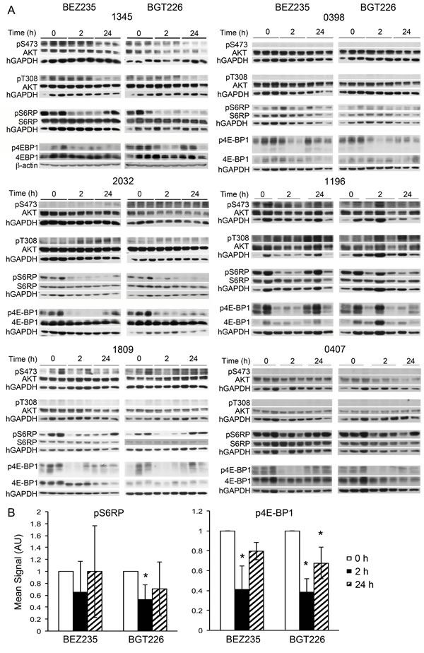 Individual patient samples respond differently to BEZ235, BGT226 and everolimus.