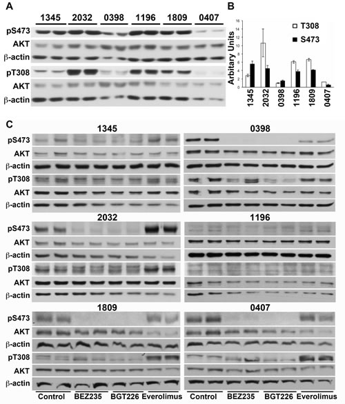 Phosphorylation of AKT in does not predict response to everolimus or dual kinase inhibitors.