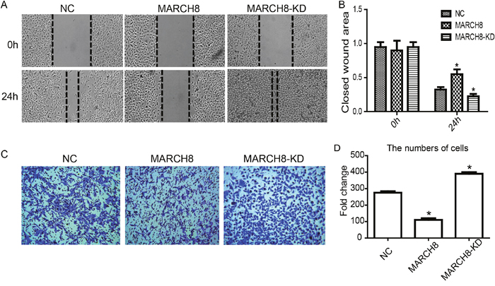 MARCH8 inhibits migration and invasion of lung cancer cell A549 in vitro.