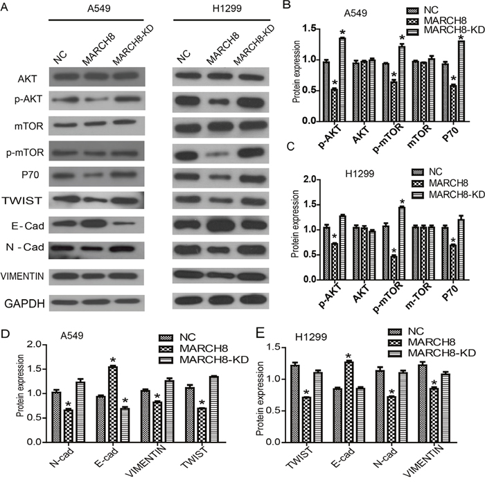 MARCH8 was involved in PI3K/AKT signaling pathway and epithelial-mesenchymal transition (EMT) process.