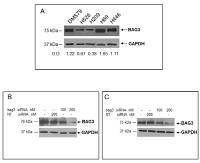 Analysis of BAG3 protein levels in human SCLC cell lines.