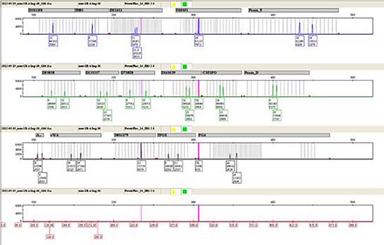 The STR method by three-color fluorescence testing.