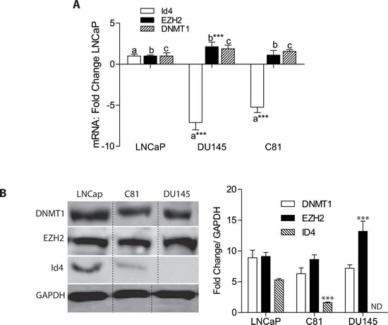 Expression of ID4, EZH2 and DNMT1 in prostate cancer cell lines.