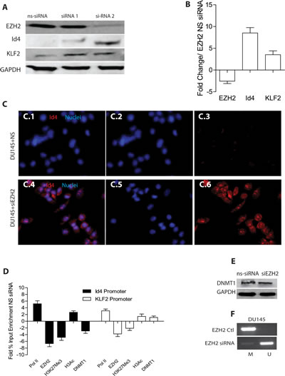 Effect of EZH2 silencing on ID4 expression.