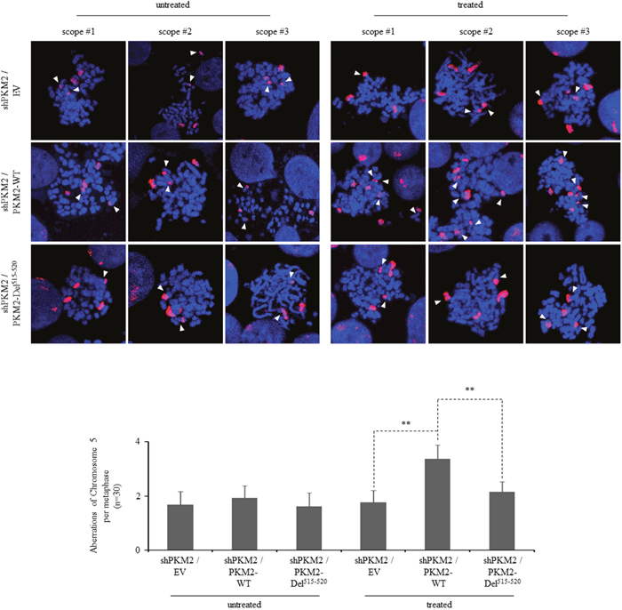 PKM2 expression increases chromosomal aberrations following DDR.