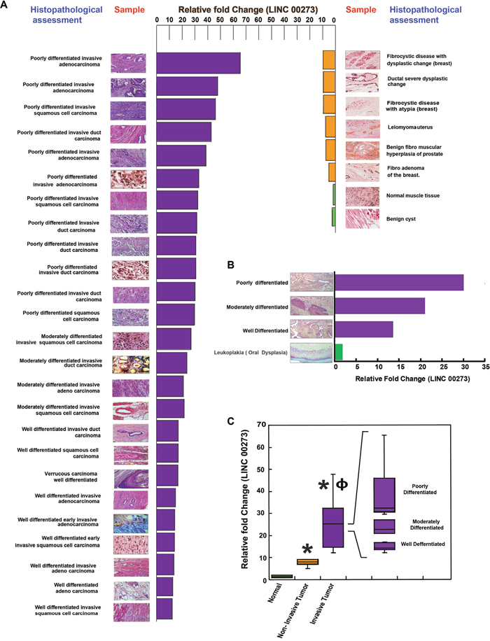 Correlation between histopathological assessment of clinical samples and their LINC000273 expressions.