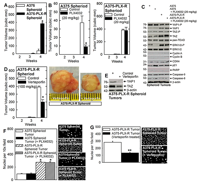 Verteporfin impact on tumor formation.