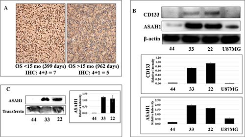 While CD133 (+) glioblastoma stem-like cancer cell lines 22 and 33 express a high level of ASAH1, limited expression of ASAH1 was seen in CD133- GSC 44 and U87MG cells.