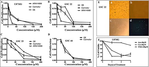 U87MG cells and GSC lines 22, 33, and 44 are highly sensitive to ASAH1 inhibitors.