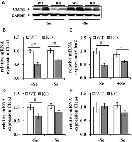 Expression levels of Clca isoforms are decreased by GPx2 knockout.