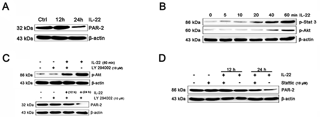 IL-22 inhibits PAR-2 expression in HaCaT keratinocytes.