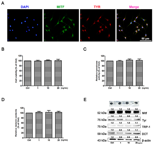 Effect of IL-22 on melanogenesis of NHEM.