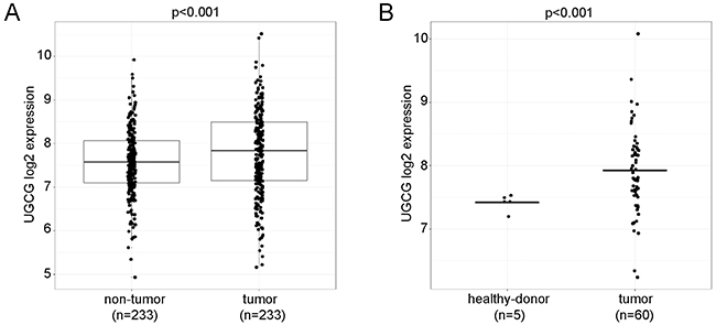 UGCG expression analysis in human HCC, non-tumor, and healthy donors.