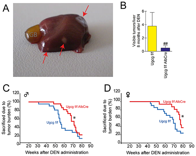 Ugcg-deficient mice show delayed DEN-induced life threatening tumor burden.