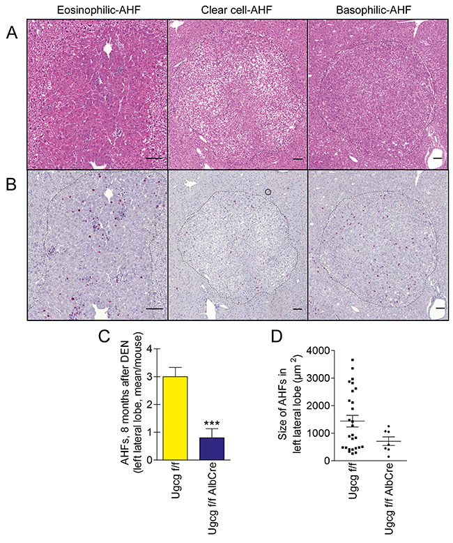 Number and area of dysplastic hepatocellular foci (AHFs) is reduced in Ugcg-deficient liver upon DEN treatment.