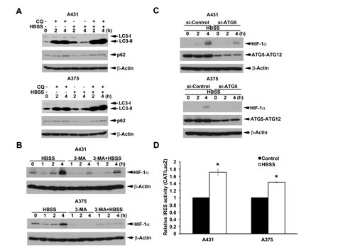 Beclin 1-independent macroautophagy also positively regulates HBSS-induced HIF-1&#x3b1; IRES activity in A431 and A375 cells.