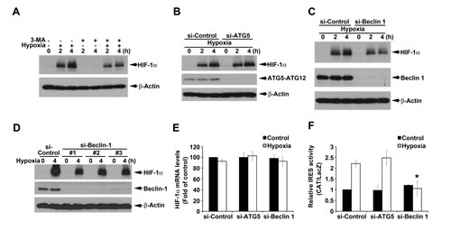 ATG5-independent macroautophagy positively regulates hypoxia-induced HIF-1&#x3b1;.