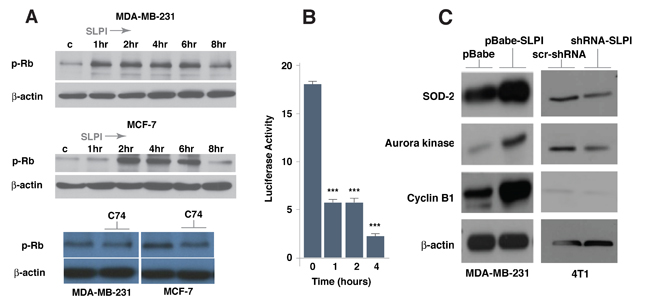 SLPI increases Rb phosphorylation and activates FoxM1 target genes in breast cancer cells.
