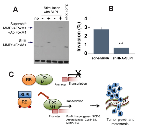 SLPI regulates binding of FoxM1 to its target MMP2 gene and increases cancer cell transmigration through an endothelial cell layer.