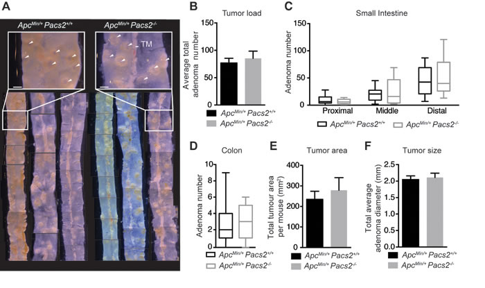 Pacs2-deficiency has no apparent effects on intestinal tumor growth in the