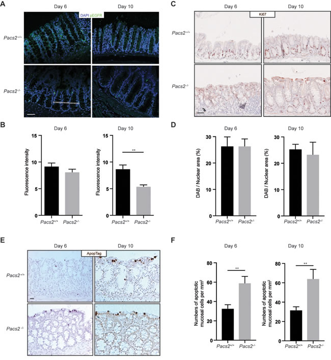 Evaluation of the regenerative response of intestinal epithelial cells in DSS-treated