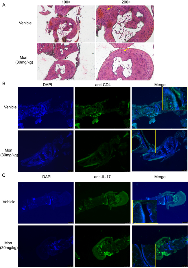 Montelukast treatment reduces pathogenic T cells in the hind paw.