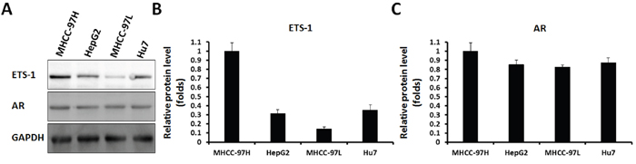 AR and ETS-1 are expressed in HCC cells.