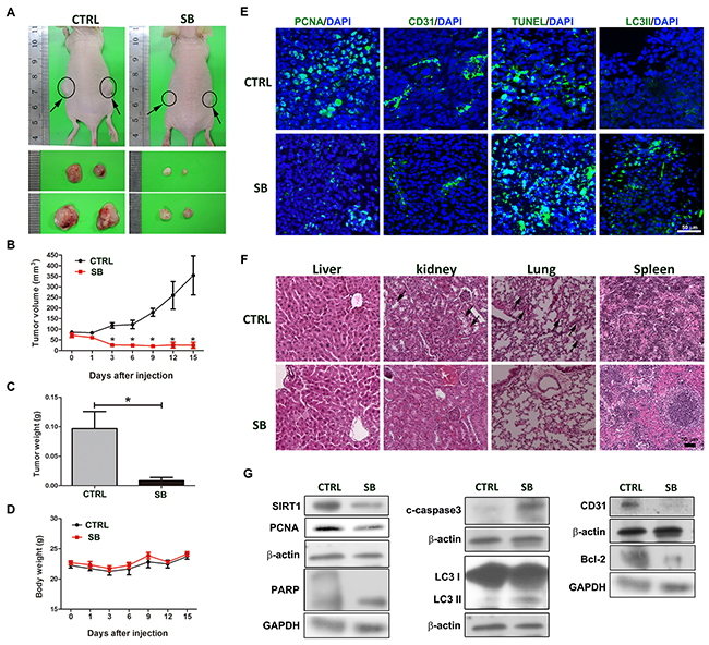 SB suppresses tumor growth in mouse xenograft models.