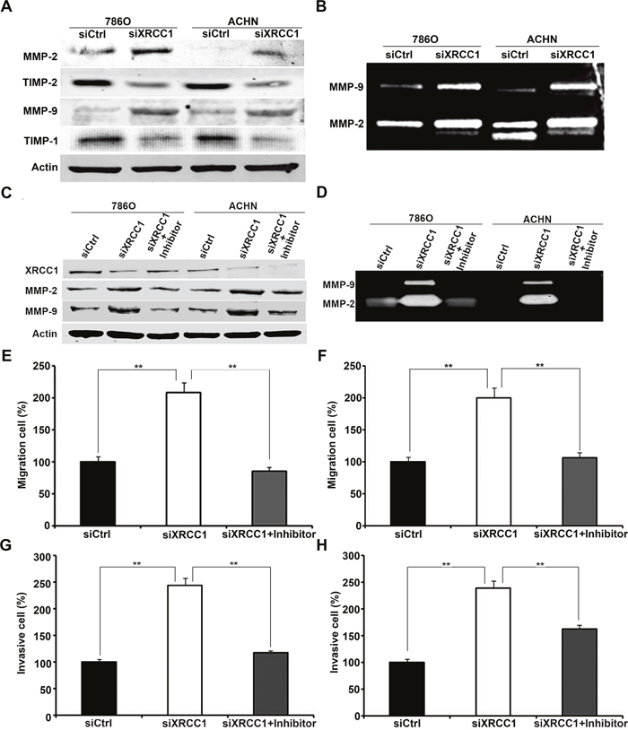 XRCC1 inhibits migration and invasion of ccRCC cells through regulating expressions and activities of MMP-2 and MMP-9.