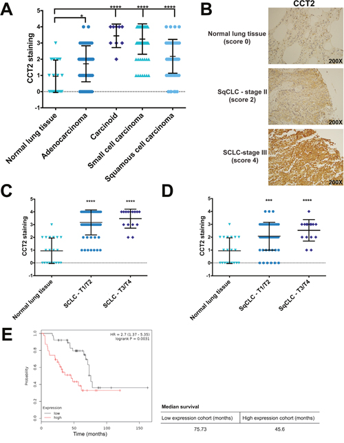 Analysis of CCT2 staining in lung cancer patient tissue.