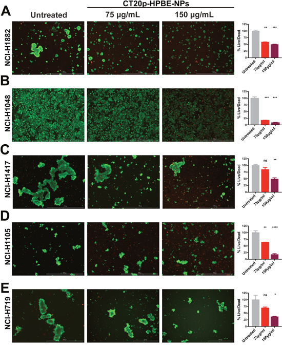 CT20p-NPs is cytotoxic to SCLC cell lines.