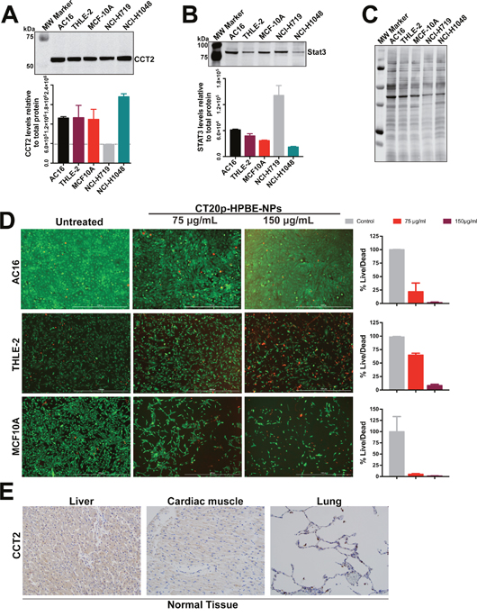 Immortalized or dividing cells but not normal tissues express CCT2.