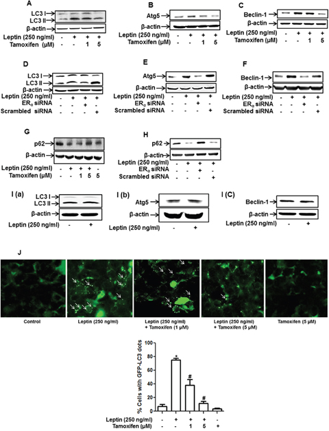Role of ER signaling in leptin-induced autophagy activation in breast cancer cells.