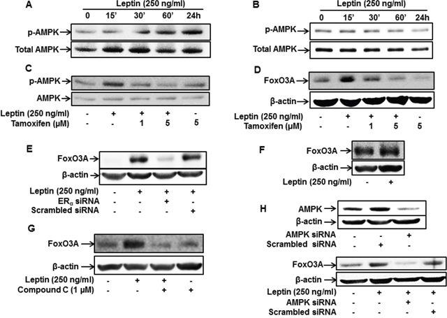 Role of ER signaling in leptin-induced AMPK phosphorylation and FoxO3A expression in MCF-7 cells.