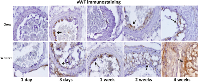 Immunohistochemical staining for von Willebrand Factor (VWF) in the ligated carotid arteries of Apoe-/- mice fed a chow diet (top row) or a Western diet (bottom row) 1 day, 3 days, 1, 2 and 4 weeks after ligation.