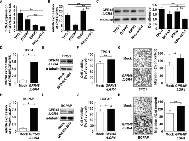 Effect of GPR48/LGR4 on viability and migration of differentiated thyroid carcinoma cells.