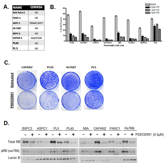 Figure1: PDA cell lines display differential responses to CDK4/6 inhibition.