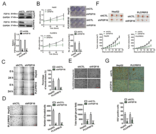 Effect of FGF16 on invasiveness and tumorigenesis of HCC cells.