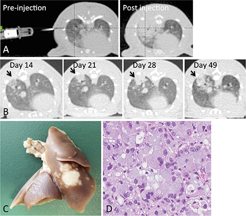 Tumor