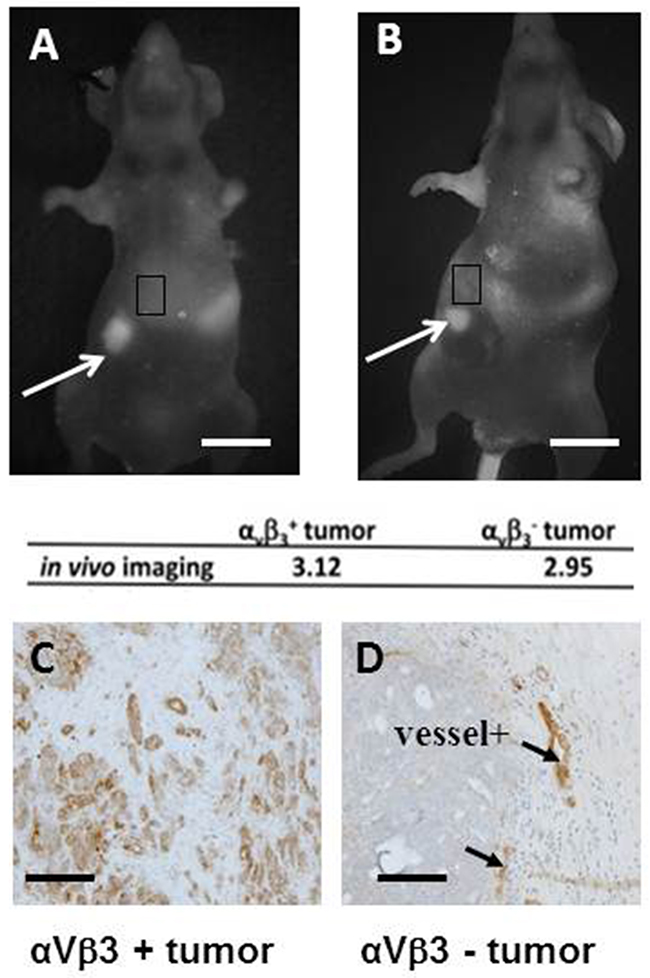 Angiostamp&#x2122; detects ovarian tumor nodules independently of the level of &#x03B1;v&#x03B2;3 integrin expression.
