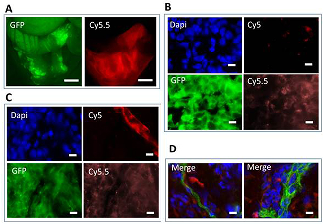 Fluorescence imaging of tumor nodules using AngiostampTM.