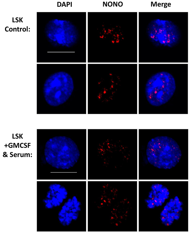 NONO sustains aggregated nuclear expression in cultured cells.
