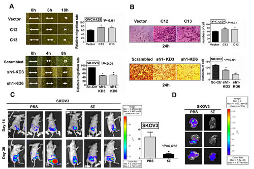 TAK1 enhances ovarian cancer cell migration/invasion in vitro and in vivo.
