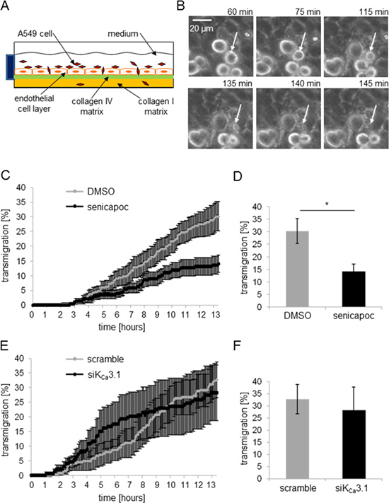 The KCa3.1 channel blocker senicapoc inhibits invasion of A549 cells through an endothelial cell layer.